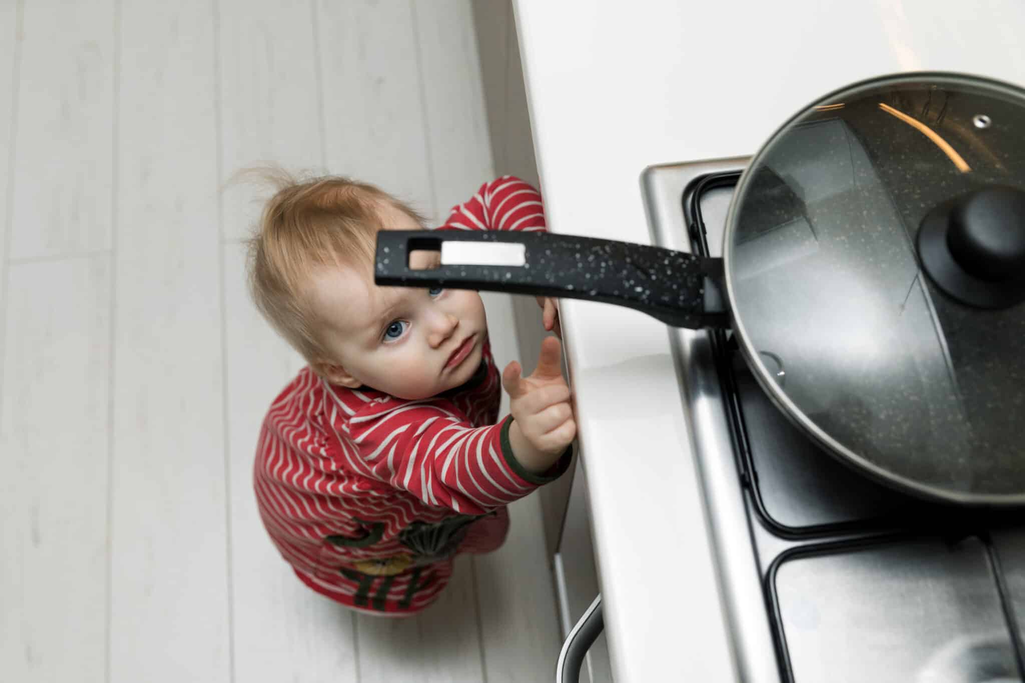 Treating Pediatric Burns in Torrance, California