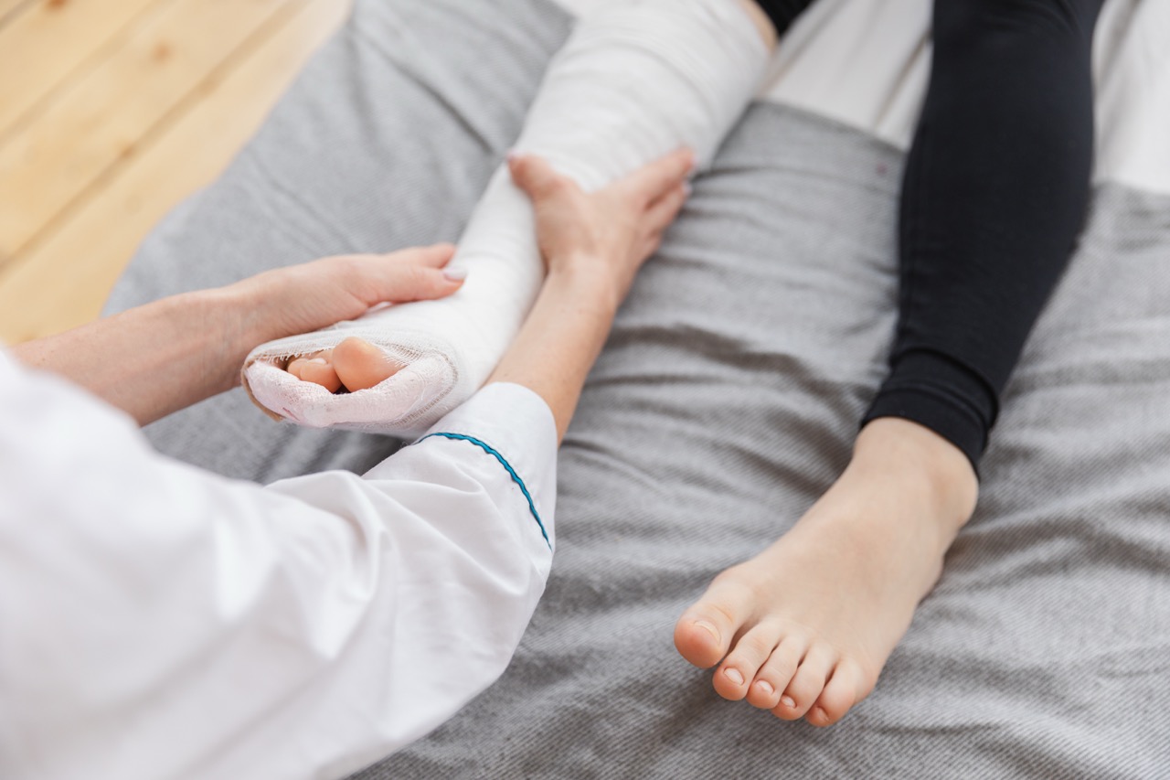 Hermosa Beach Pediatric Sports Injury and Fracture Care