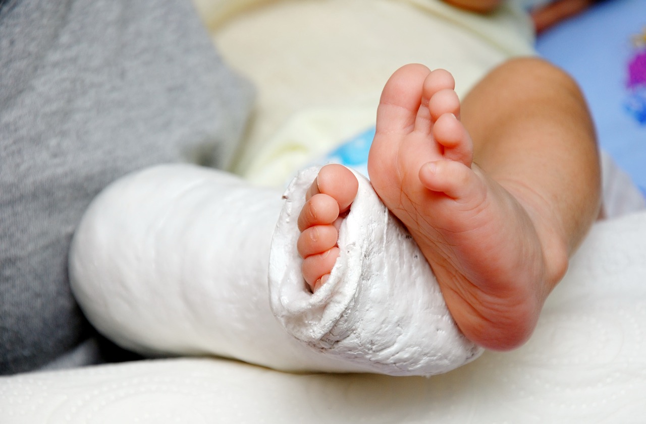 Pediatric Fracture Care for Active Families on the Palos Verdes Peninsula