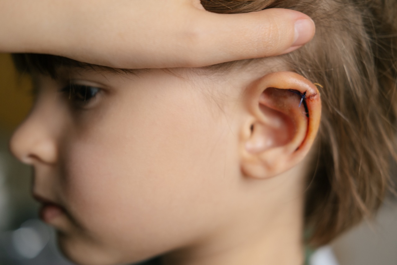 Does Your Child's Cut Need Stitches? Here's How to Tell